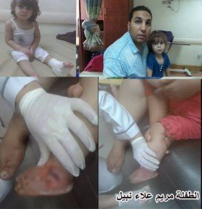 الطفله مريم علاء نبيل