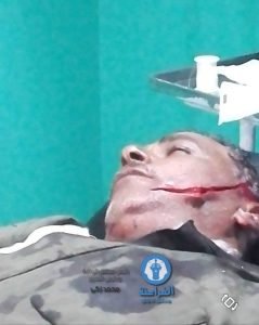 عاطل يطعن حماه بسكين فى وجه ببلقاس1