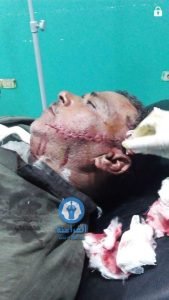 عاطل يطعن حماه بسكين فى وجه ببلقاس2