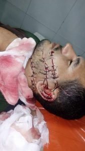 13532768_1796087237293667_4379037087739283123_n