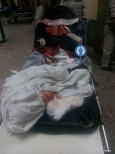 -عاجل. مجهولون يطلقون النار على سيارة واصابه من فيها ويفرون ب نبروه