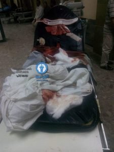 -عاجل. مجهولون يطلقون النار على سيارة واصابه من فيها ويفرون ب نبروه3